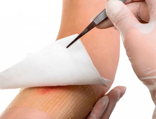 Gasa esteril algodon hidrofilo caja de 100 unidades